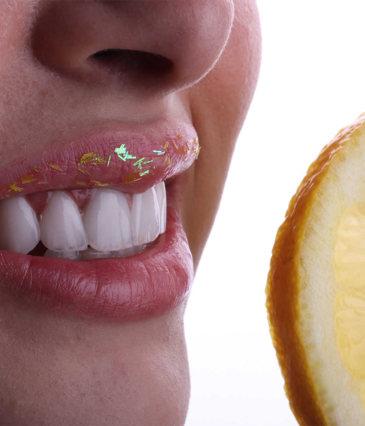 Photo après traitement avec Facettes dentaires à Alger, El Mohammadia en Algérie