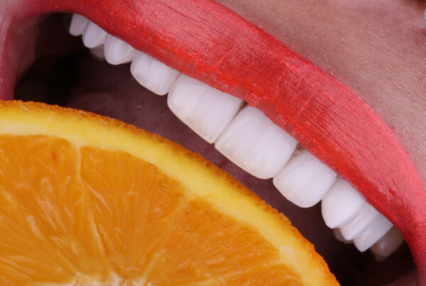 Hollywood Smile à El Mohammadia, Alger en Algérie, dentisterie esthétique visant à restaurer des dents à la fois blanches et parfaitement alignées, sourire hollywoodien.