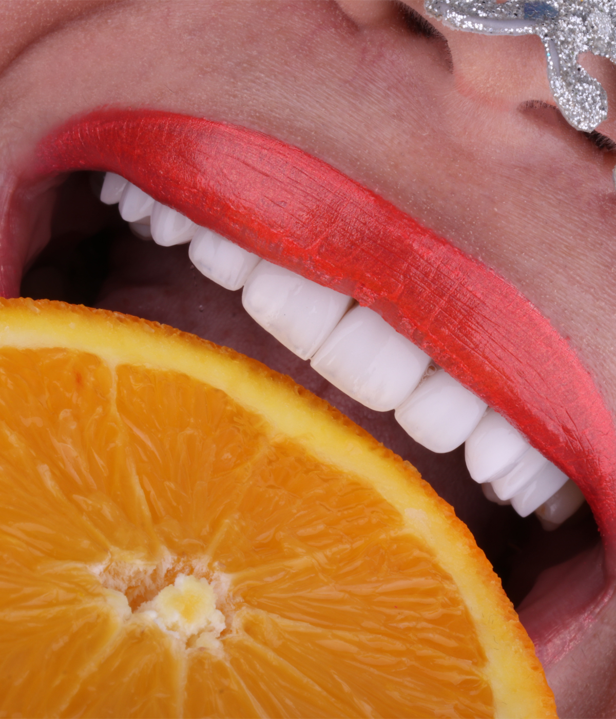 Hollywood Smile à El Mohammadia, Alger en Algérie, dentisterie esthétique visant à restaurer des dents à la fois blanches et parfaitement alignées, sourire hollywoodien.