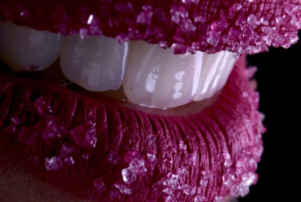 facettes dentaires ou blanchiment dentaire en Algérie à Alger, patients Français ou Expatriés vivant en France