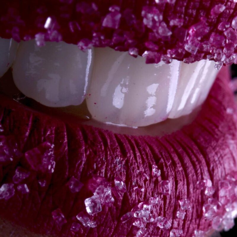 facettes dentaires ou blanchiment dentaire en Algérie à Alger, patients Français ou Expatriés vivant en France