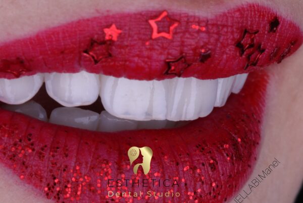 Couronnes et bridges posés en Algérie : durée de vie, garanties et entretien pour les patients vivant en France