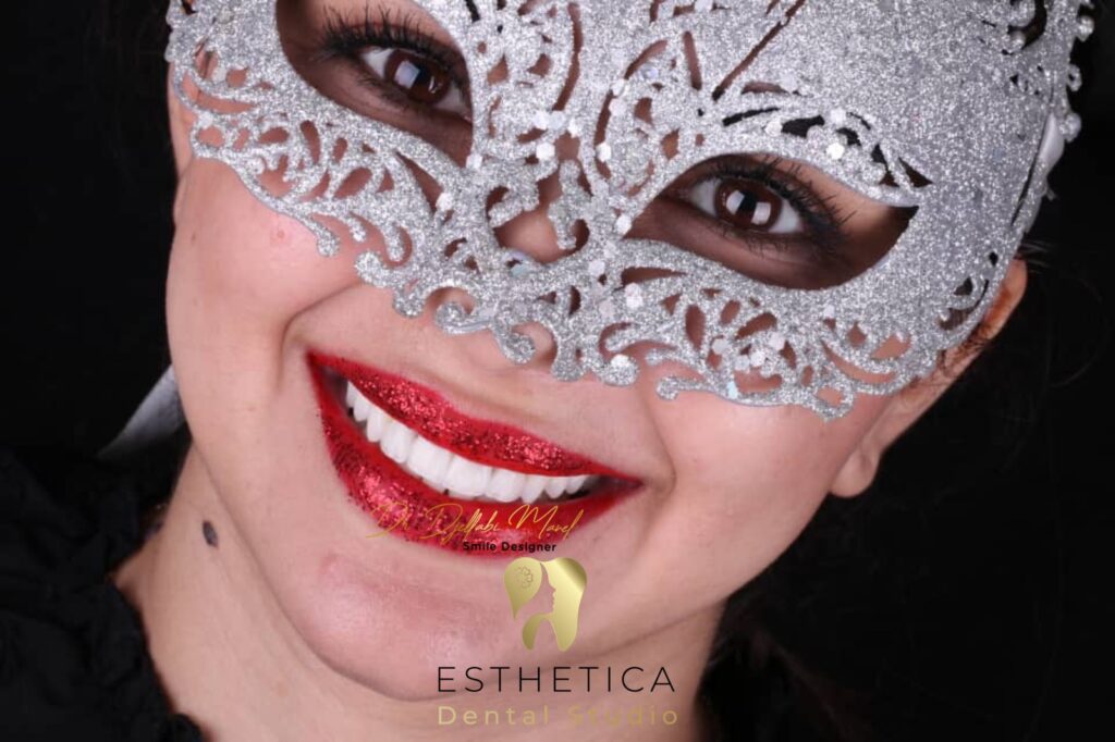 Dentisterie esthétique et hollywood smile à Alger, Algérie chez Esthetica Dental Studio à El Mohammadia, Alger, Algérie