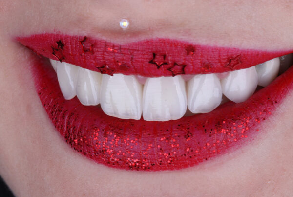 Blanchiment des dents chez le dentiste à Alger en Algérie