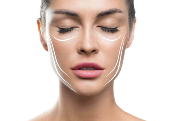 endolift à Alger, lifting sans chirurgie du visage, lifting des joues, lifting des tempes, lifting du double menton, lifting bas du visage en Algerie