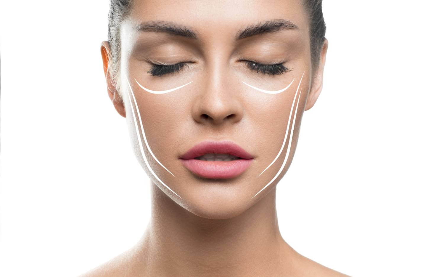 Guide Complet sur l’Endolift : Lifting du Visage Sans Chirurgie à Alger – Algérie