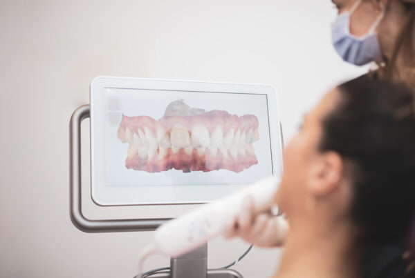 Scan intra-oral 3D d'un patient pour effectuer un traitement avec gouttière dentaire transparente à Alger en Algérie