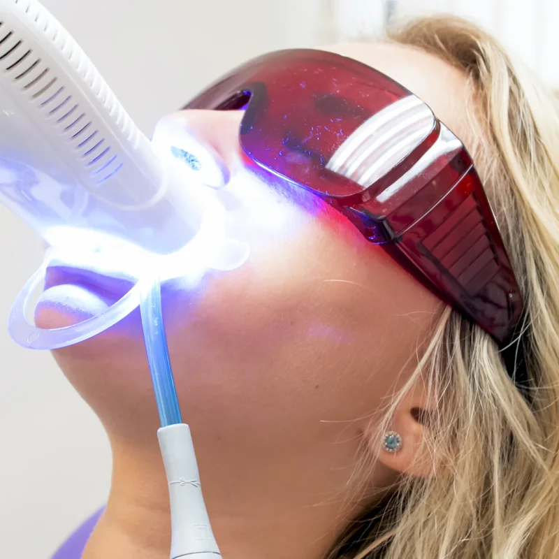 blanchiment dentaire à Alger en Algérie