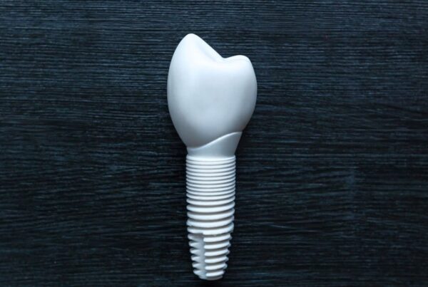 implant dentaire en Zircone à Alger en Algérie