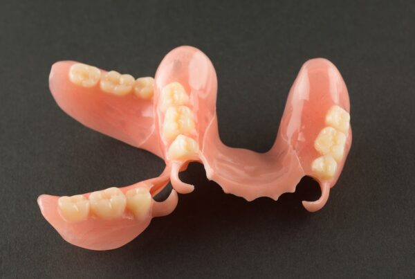 prothèse dentaire flexible à Alger en Algérie