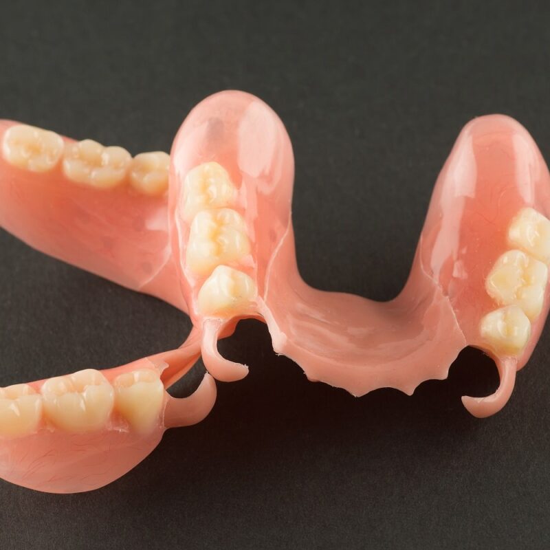 prothèse dentaire flexible à Alger en Algérie