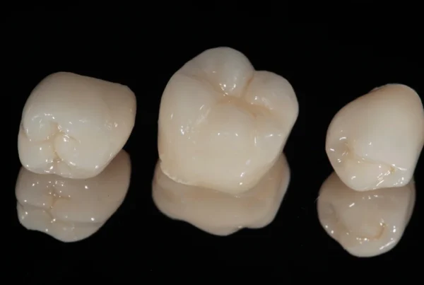 types de couronnes dentaires, zircone, céramique, céramo-metalique, céramo-céramique en Algérie à Alger