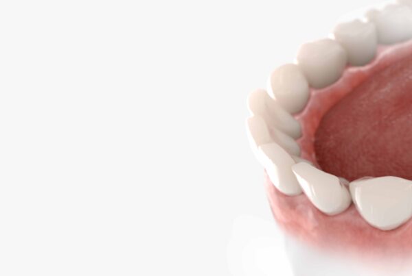 Entretien implants dentaires en Algérie